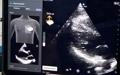 AI-guided echo exam using Caption Health integrated with the GE Vscan in the GE booth at ACC.24.