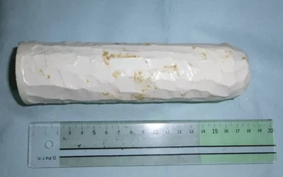 Case from Japan. The silicone foreign body, made by the patient himself, who inserted it into their rectum and could not retrieve it. The item after it was removed by manual extraction measured 18 x 4 cm. Images courtesy of Case Reports in Gastroenterology