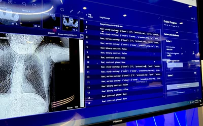 Enlitic AI to standardize RIS PACS terms and protocols RSNA 2024. Photo by Dave Fornell