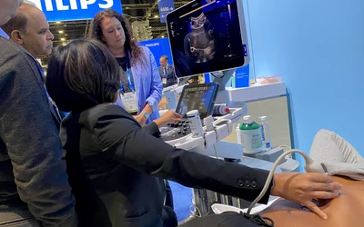 Abdominal Ultrasound Philips Epic RSNA 2024. Photo by Dave Fornell
