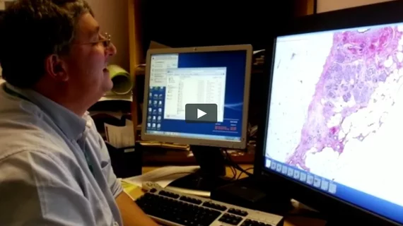 The Adoption and Benefits of Digital Pathology for Primary Diagnosis