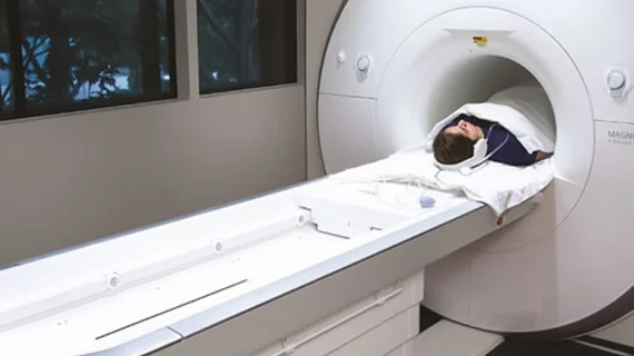 A new artificial intelligence tool can detect heart disease on cardiovascular MRI scans in seconds with equal or superior precision as clinicians. 