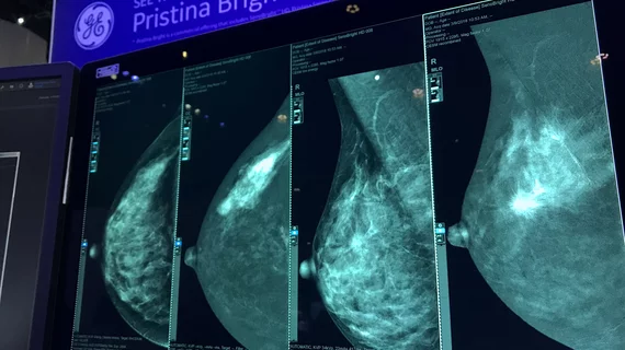 An example of contrast enhanced mammography at RSNA 2022. It shows the original mammograms to the left, and the contrast enhanced breast imaging on the right. The contrast helps enhance areas of high vascular activity, which is typical in cancer growths. Photo by Dave Fornell