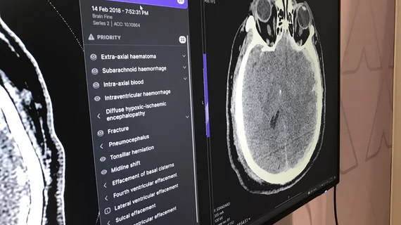 Example of data generated by an automated artificial intelligence (AI) brain CT assessment tool from Annalise.ai at RSNA 2022. What does brain imaging look like?