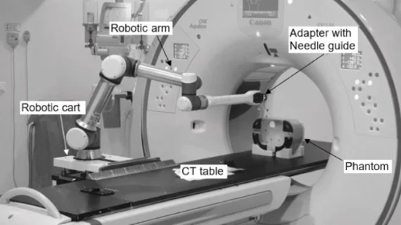 #robotassistedprocedures #interventionalprocedures