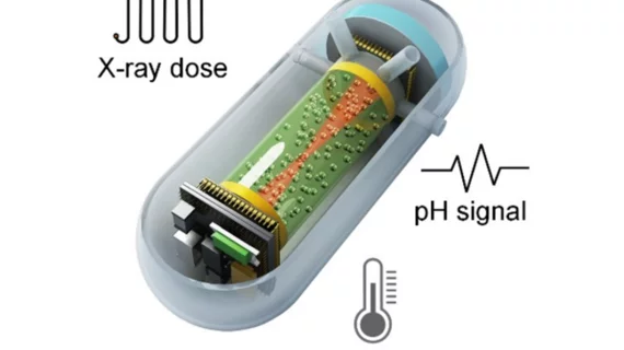 x-ray dosimetry capsule monitors radiation dose during radiotherapy