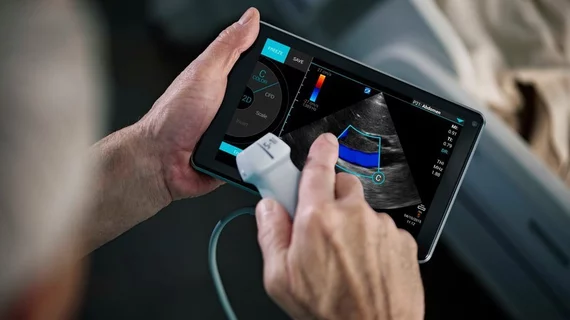POCUS hand held ultrasound SonoSite iViz.