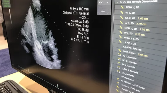 Artificial intelligence automated measurements on an echocardiogram on the Siemens SyngoDynamics cardiovascular imaging and information solution. AI is helping speed workflows and complete tedious tasks faster and more accurately that humans, allowing sonographers and cardiologists to be more efficient. Photo by Dave Fornell