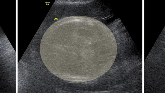 fetal weight measurements ultrasound