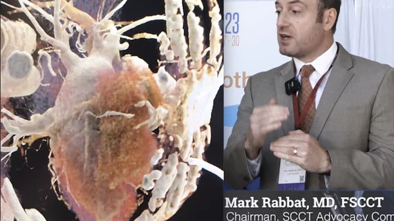 Mark Rabbat, MD, director of cardica CT at Loyola, discusses legislative advocacy efforts by SCCT to gain wider reimbursement for cardiac CT. #SCCT #SCCT23 #SCCT2023