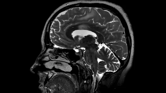 MRI image from a head scan