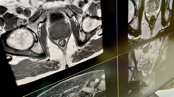 Prostate MRI GE RSNA23 DF 2