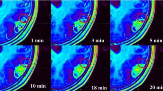 Using multiple MRI phases after contrast injection significantly ...