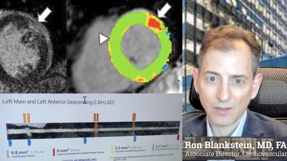 Ron Blankstein, MD, FACC, FASNC, MSCCT, FASPC, associate director, cardiovascular imaging program, director, cardiac computed tomography, Brigham and Women’s Hospital, and a professor of medicine and radiology, Harvard Medical School, explains a few of the recent advancements in cardiac MRI, nuclear imaging and computed tomography.