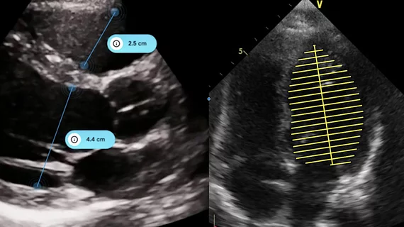 The iCardio.ai EchoMeasure AI software to automate measurements for cardiac echo imaging. It was FDA cleared in October 2024.