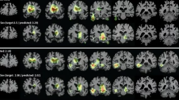 AI detects subtle changes in images over time.