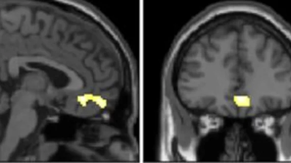 Researchers track dopamine receptors to study its impact on cognitive function.