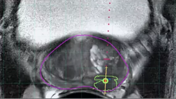 Philips UroNav system gains FDA clearance