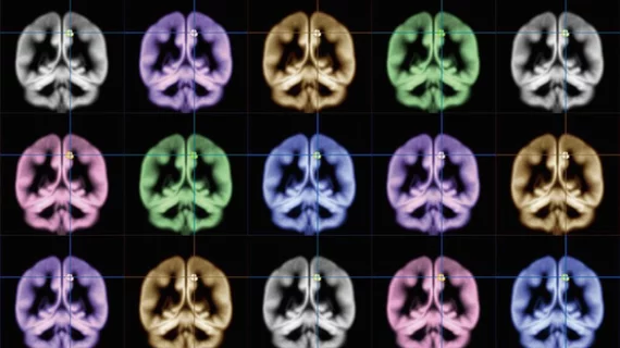 brain scan schizophrenia
